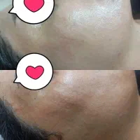 مرکز زیبایی نوژا (تخفیف پلاژن تراپی و میکروکارنت )|خدمات آرایشگری و زیبایی|جهرم, |دیوار