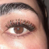 کاشت مژه هیدن و فیشر تخفیف