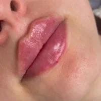 زیبایی لیزر لاغری