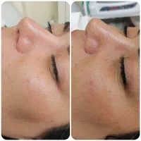 پاکسازی و فیشال تخصصی|خدمات آرایشگری و زیبایی|شاهین‌شهر, فردوسی|دیوار