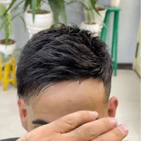 پروتز مو|آرایشی، بهداشتی، درمانی|تهران, نارمک|دیوار