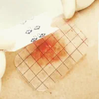 لوازم زخم بسترودرمان|آرایشی، بهداشتی، درمانی|کلاردشت, |دیوار