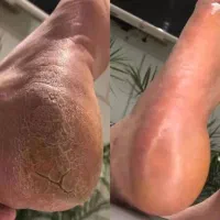 خدمات ارایشی|خدمات آرایشگری و زیبایی|کارون, |دیوار