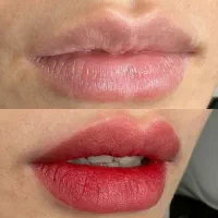 جشنواره اقتصادی تخصصی ریمووتاتو شیدلب وبنمژه و..