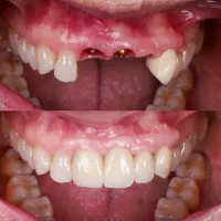 دندانپزشکی تخصصی،ایمپلنت،اوردنچر،ارتودنسی|خدمات آرایشگری و زیبایی|تبریز, |دیوار