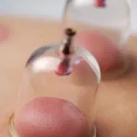 حجامت . بادکشی