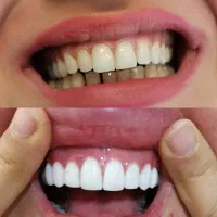 دندانپزشکی و زیبایی