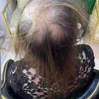 اکستنشن موطبیعی نصب وسرچسب وریمو آف ویژه باضمانت|خدمات آرایشگری و زیبایی|تهران, ستارخان|دیوار