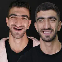 ارائه کلیه خدمات دندانپزشکی با اقساط ۴ تا ۱۲ ماه