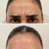 ژل و زیبایی