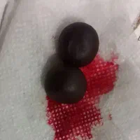 هبهاب خونی و هبهاب آفریقا انواع مهره