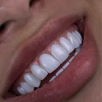 خدمات زیبایی دندانپزشکی