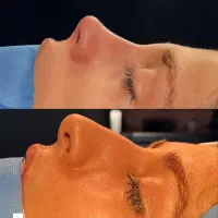 مشاوره و نوبت ویزیت رایگان بینی|خدمات آرایشگری و زیبایی|کرج, عظیمیه|دیوار