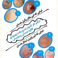 درد رو تموم کن برای خودت