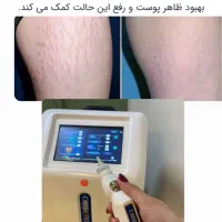 لیزر بوتاکس پی ارپی توسط دکتر|خدمات آرایشگری و زیبایی|مشهد, وکیلآباد|دیوار