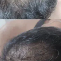 اموزش تخصصی وپیشرفته پی آرپی وبایوفیلر