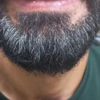 دندانسازی (دندان مصنوعی)پروتز متحرک|خدمات آرایشگری و زیبایی|قم, شاه ابراهیم|دیوار