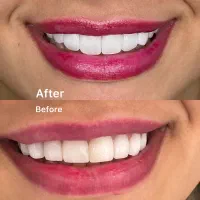 ادمین اینستاگرام