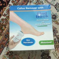 سوهان برقی ترک پا