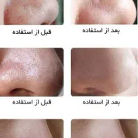 تخفیف ویژه پاکسازی پوست صورت ویژه بانوان