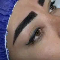 جشنواره کاشت ابرو سوپرنچرال با قیمت تخفیفی و اقساط