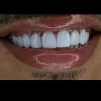 دندانپزشک دندان زیبای تو