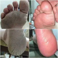 پدیکورVIPتخفیف ویژه عید/فیشال دست/ژلیش