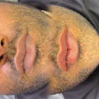 رفع تیرگی لب آقایان