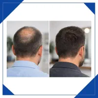 این نتیجه که میبینی واقعی