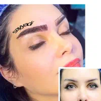 کاشت تخصصی ابرو