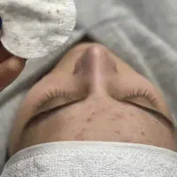 فیشیال و پاکسازی پوست بانوان|خدمات آرایشگری و زیبایی|کرمانشاه, |دیوار