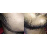 مرد شو|آرایشی، بهداشتی، درمانی|قوچان, |دیوار