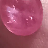 دو عدد یاقوت برمه بدون هرگونه بهسازی صدرصد طبیعی