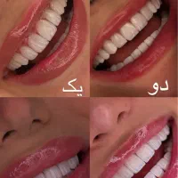 استخدام منشی دندانپزشکی و دستیار (حتی کار اموز)|استخدام درمانی، زیبایی، بهداشتی|تهران, دردشت|دیوار