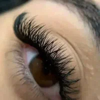 کاشت مژه هیدن وفیشر