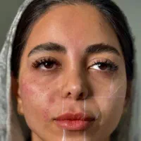 مادلینگ صورت به سلیقه توزیبایی را تجربه کنید.|خدمات آرایشگری و زیبایی|قم, سالاریه|دیوار