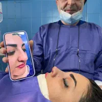 رینو پلاسی عمل بینی