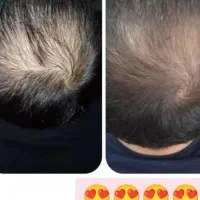 مراقبتی پوست و مو|آرایشی، بهداشتی، درمانی|سنندج, |دیوار