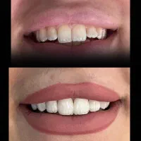 جشنواره دندانپزشکی درمانی و زیبایی|خدمات آرایشگری و زیبایی|تهران, هفت حوض|دیوار