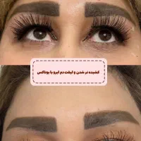 جشنواره بوتاکس|خدمات آرایشگری و زیبایی|اردبیل, |دیوار