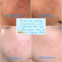 محصولات پوستی ارگانیک|خدمات آموزشی|کرمان, |دیوار