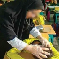 محلول شپش و رشک در چهل دقیقه حضوری و غیر حضوری|آرایشی، بهداشتی، درمانی|قم, نیروگاه|دیوار