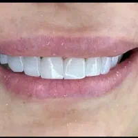 دستیار دندانپزشکی