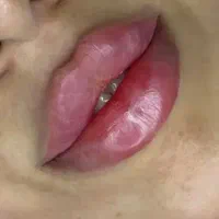 اف ژل