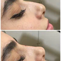 اصلاح فرم|خدمات آرایشگری و زیبایی|سنندج, |دیوار