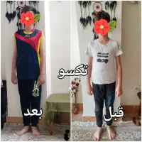 طبیعی و بدون بازگشت بدنتو پر و خوش اندام کن|آرایشی، بهداشتی، درمانی|سبزوار, دانشگاه آزاد|دیوار