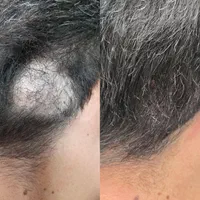 میکروبلیدینگ آقایان ،شیدینگ لب، بن مژه ،اسکالپ سر|خدمات آرایشگری و زیبایی|اصفهان, نقش جهان|دیوار