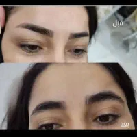 ریموو(پاک کردن)تتو ابرو چشم لب