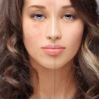 آموزش حرفه ای روتوش چهره