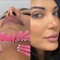 جراحی پلک غبغب صورت نخ آنزیم فیلر مزو ژل بوتاکس|خدمات آرایشگری و زیبایی|کرج, گوهردشت|دیوار